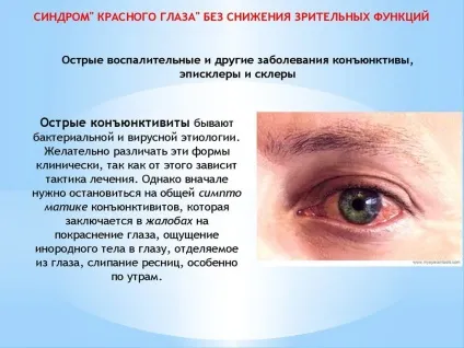 Синдром червоного ока