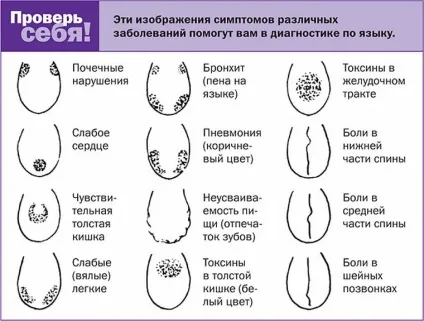 Сліди зубів на мові причини нетертих відбитків з боків і по всій поверхні (відбитки зубів на мові) Сліди зубів на мові причини нетертих відбитків з боків і по всій поверхні