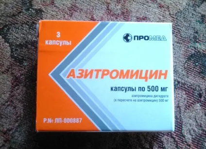 Способи лікування фімозу без обрізання (лікування) Способи лікування фімозу без обрізання