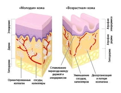Старіння шкіри ознаки, типи, профілактика (верхніх особи нижні) Старіння шкіри ознаки, типи, профілактика