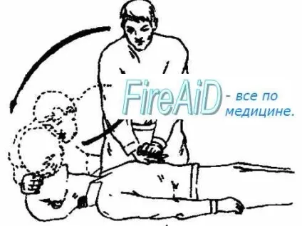 Техніка проведення непрямого масажу серця - методичка по першої допомоги (техніка) Техніка проведення непрямого масажу серця - методичка по першої допомоги
