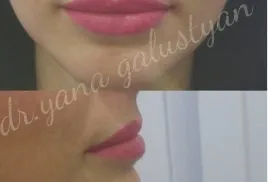 Татуаж губ (перманентний макіяж губ) (татуаж) Татуаж губ (перманентний макіяж губ)