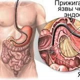 Чи важко ковтати зонд скальпель - медичний інформаційно-освітній портал