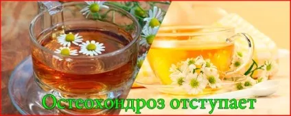 Трави від остеохондрозу - які і як використовувати (трави) Трави від остеохондрозу - які і як використовувати