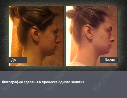 Поліпшення форми голови або «як опуклі потилицю» (форма) Поліпшення форми голови або «як опуклі потилицю»