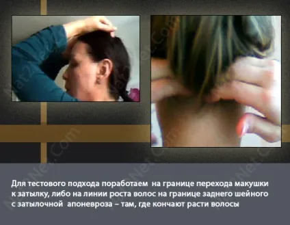 Поліпшення форми голови або «як опуклі потилицю» (оптимізації форми голови) Поліпшення форми голови або «як опуклі потилицю»