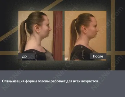 Поліпшення форми голови або «як опуклі потилицю» (оптимізація) Поліпшення форми голови або «як опуклі потилицю»