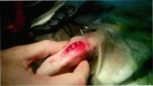 Вивих колінної чашечки у собак причини, симптоми і лікування (колінної) Вивих колінної чашечки у собак причини, симптоми і лікування