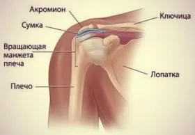 Тендиніт плечового суглоба лікування і профілактика (плечового) Тендиніт плечового суглоба лікування і профілактика