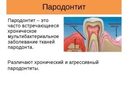 Хронічний пародонтит лікування