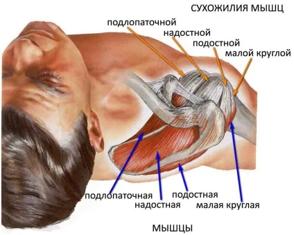 Хрускіт в плечовому суглобі причини, лікування, профілактика (причини) Хрускіт в плечовому суглобі причини, лікування, профілактика