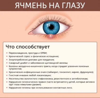 Ячмінь на оці як лікувати медикаментозно, ніж в домашніх умовах на нижньому і верхньому столітті, (медикаментозно) Ячмінь на оці як лікувати медикаментозно, ніж в домашніх умовах на нижньому і верхньому столітті,