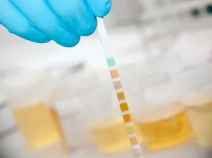 Запах ацетону в сечі методи усунення, про що говорить (сечі) Запах ацетону в сечі методи усунення, про що говорить