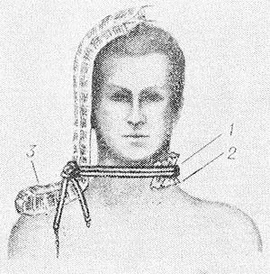 Палять кровоспинний 1