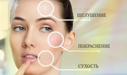 Жовтий пілінг - ретиноєвий або ретинолової, відгуки про процедуру, фото до і після (після) Жовтий пілінг - ретиноєвий або ретинолової, відгуки про процедуру, фото до і після