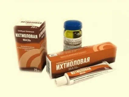 Жировик на руці і пальцях як позбутися, причини появи під шкірою (появи) Жировик на руці і пальцях як позбутися, причини появи під шкірою