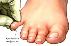 Свербіж та почервоніння шкіри на нозі перший тривожний сигнал (сигнал) Свербіж та почервоніння шкіри на нозі перший тривожний сигнал