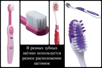Зубна щітка різновиди і правила вибору (правила) Зубна щітка різновиди і правила вибору