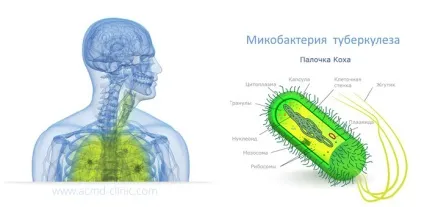 Кров з носа у дитини причини, як зупинити, лікування (носа) Кров з носа у дитини причини, як зупинити, лікування