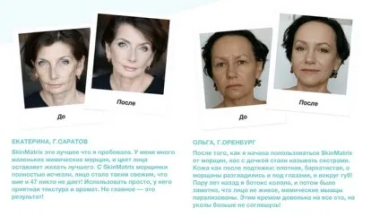 Крем скін матрикс відгуки на skin matrix (крем) Крем скін матрикс відгуки на skin matrix