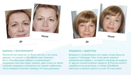 Крем скін матрикс відгуки на skin matrix (відгуки) Крем скін матрикс відгуки на skin matrix