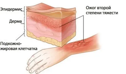 5 П'ять сильних болів, які може відчути людина (чоловік) 5 П'ять сильних болів, які може відчути людина