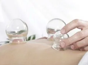 Банки при кашлі ефективне лікування застуди (лікування) Банки при кашлі ефективне лікування застуди