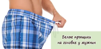 Білі прищики на голівці у чоловіків причини появи і лікування (причини) Білі прищики на голівці у чоловіків причини появи і лікування