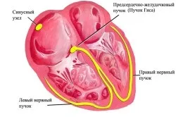 Брадикардія у дітей причини, симптоми і лікування
