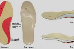Болить шишка на пальці ноги (місці утворення шишки) Болить шишка на пальці ноги