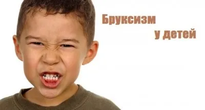 Бруксизм у дітей причини, симптоми і його лікування (симптоми) Бруксизм у дітей причини, симптоми і його лікування