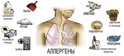 Бронхіальна астма інфекційно алергічна форма залежна (бронхіальна) Бронхіальна астма інфекційно алергічна форма залежна