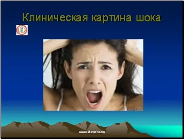 Травматичний і опіковий шок (травматичний) Травматичний і опіковий шок
