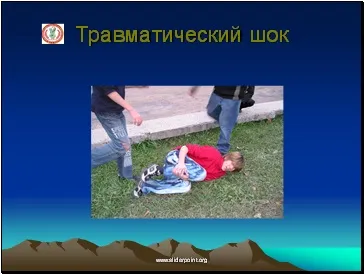 Травматичний і опіковий шок (опіковий) Травматичний і опіковий шок