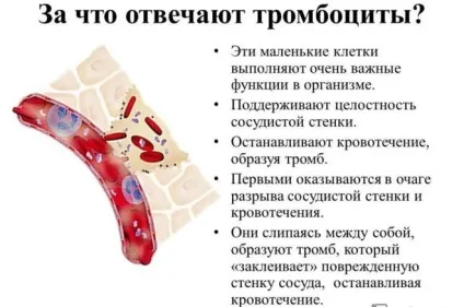 Тромбоцитопенія причини і лікування у дорослих (причини) Тромбоцитопенія причини і лікування у дорослих