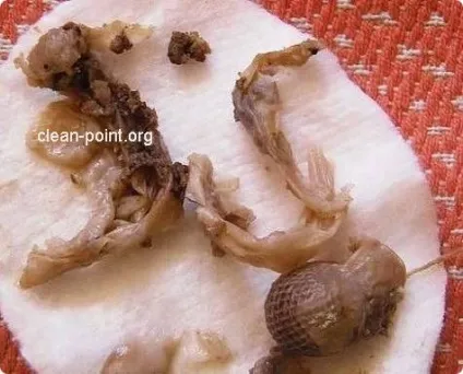 Що витягує тампон clean point і що виходить з тампоном (point) Що витягує тампон clean point і що виходить з тампоном