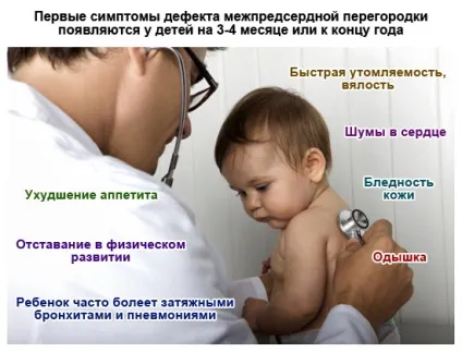 Дефект міжпередсердної перегородки (ДМПП) у дорослих і дітей (дефект) Дефект міжпередсердної перегородки (ДМПП) у дорослих і дітей