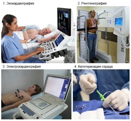 Дефект міжпередсердної перегородки (ДМПП) у дорослих і дітей (міжпередсердної) Дефект міжпередсердної перегородки (ДМПП) у дорослих і дітей