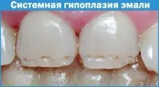 Діагнози дитяча стоматологія