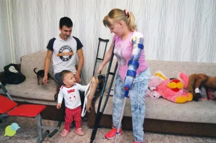 Дівчина без рук і ніг вчиться жити з подарованими протезами