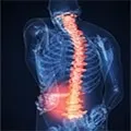 Дисцит хребта симптоми і лікування (дисцит) Дисцит хребта симптоми і лікування