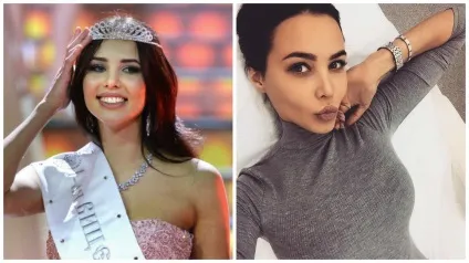 До і після 12 українських знаменитостей, які зробили пластику (які) До і після 12 українських знаменитостей, які зробили пластику