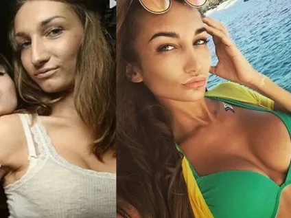 До і після 12 українських знаменитостей, які зробили пластику (пластику) До і після 12 українських знаменитостей, які зробили пластику