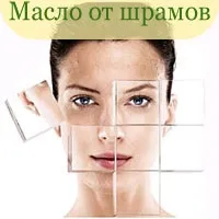 Ефірна олія від шрамів і рубців, вибір і застосування (рубців) Ефірна олія від шрамів і рубців, вибір і застосування