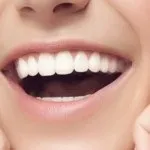 Фторування молочних зубів (фторування) Фторування молочних зубів