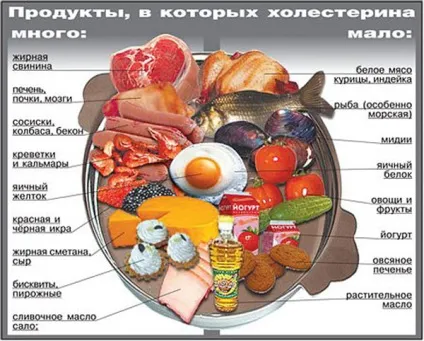 Генералізований атеросклероз судин - що це таке, причина смерті, симптоми, лікування (атеросклероз) Генералізований атеросклероз судин - що це таке, причина смерті, симптоми, лікування