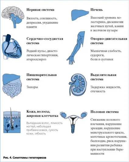 Гіпотиреоз у жінок після 50 років симптоми і лікування, феломена (лікування) Гіпотиреоз у жінок після 50 років симптоми і лікування, феломена