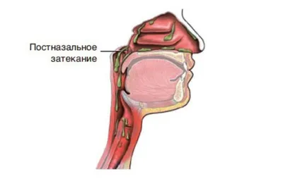 Гомеопатія від кашлю список препаратів з урахуванням різних симптомів (гомеопатія) Гомеопатія від кашлю список препаратів з урахуванням різних симптомів
