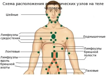 Гомеопатія при запаленні лімфовузлів (лімфаденіт) (запальний процес лімфовузлах) Гомеопатія при запаленні лімфовузлів (лімфаденіт)
