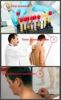 Голкотерапія при шийному остеохондрозі рекомендації та протипоказання лікарів (рекомендації) Голкотерапія при шийному остеохондрозі рекомендації та протипоказання лікарів